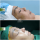 Slider image (9) Dr. Ho Co - Aesthetics and Plastic Surgery in Vietnam